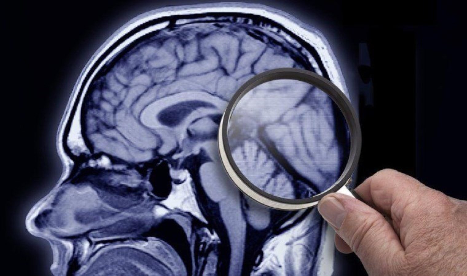 demans-ve-alzheimer-hastaligi-IhXE1fSj.jpg