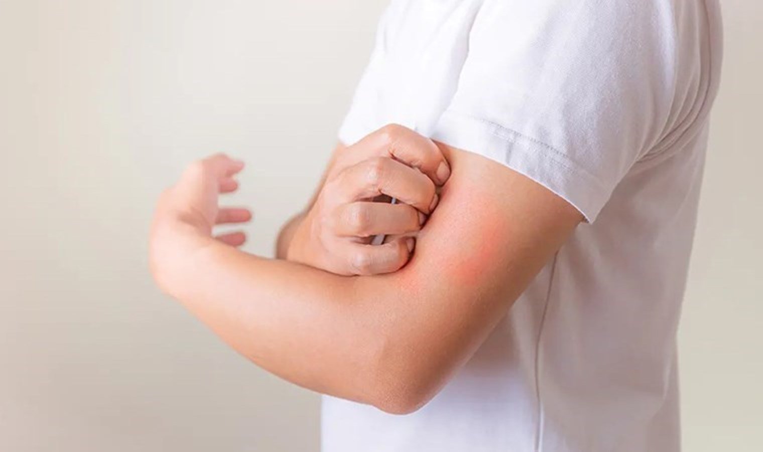 lyme-enfeksiyonu-nedir-ve-nasil-bulasir-Mqgm4rsR.jpg