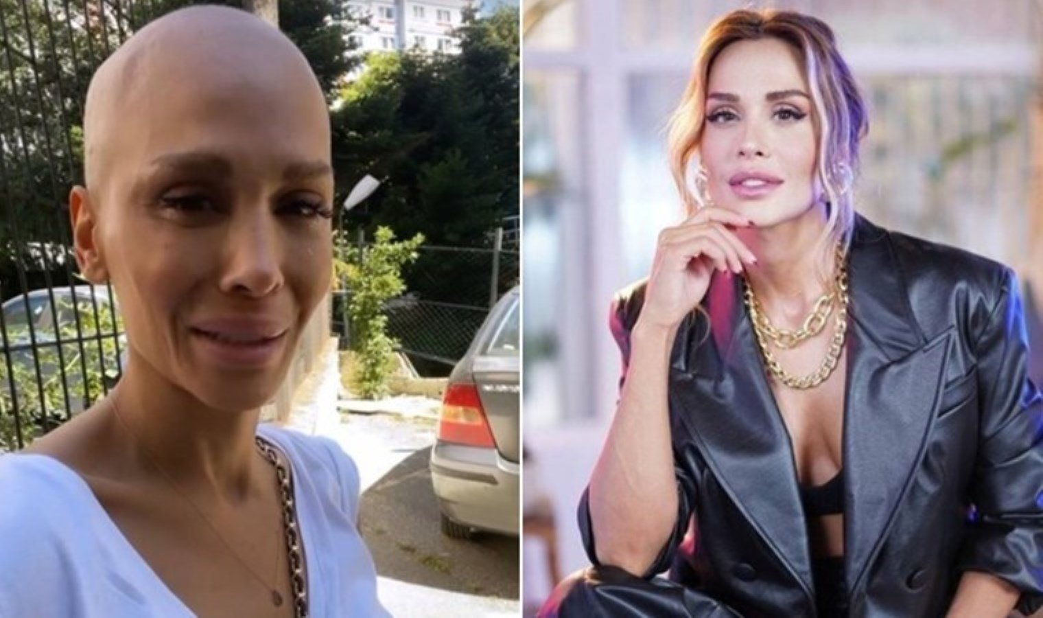simal-mucadele-dolu-bir-hikaye-xJK2qtrs.jpg