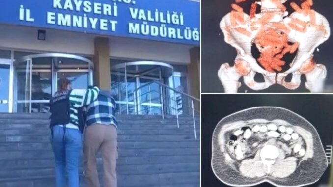 kayseride-uyusturucu-operasyonu-88-kapsul-afyon-sakizi-ele-gecirildi-XPGnVEw3.jpg
