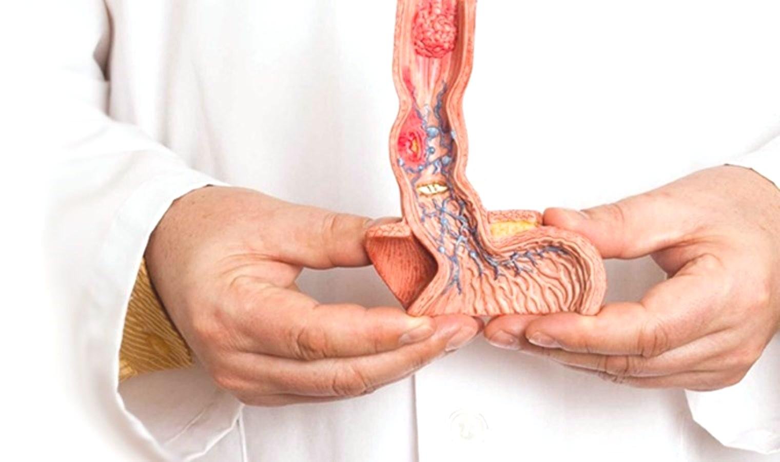 hpv-ve-penis-kanseri-howardin-hikayesi-ve-farkindalik-cagrisi-CK7KBAf6.jpg